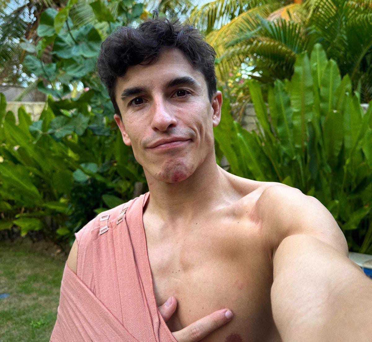Insiden di Sirkuit Mandalika, Marc Marquez Cedera Bahu Usai Diseruduk Bezzecchi