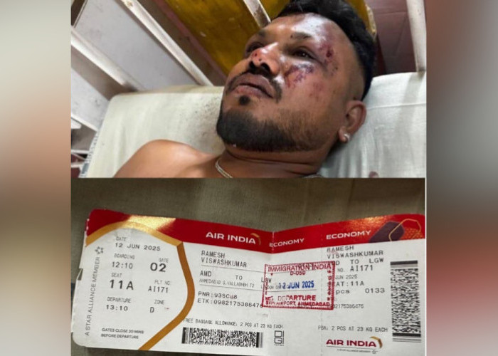 Ajaib! Cerita dan Kesaksian Ramesh, Satu-satunya Penumpang Air India yang Selamat: Orang-orang Terbakar